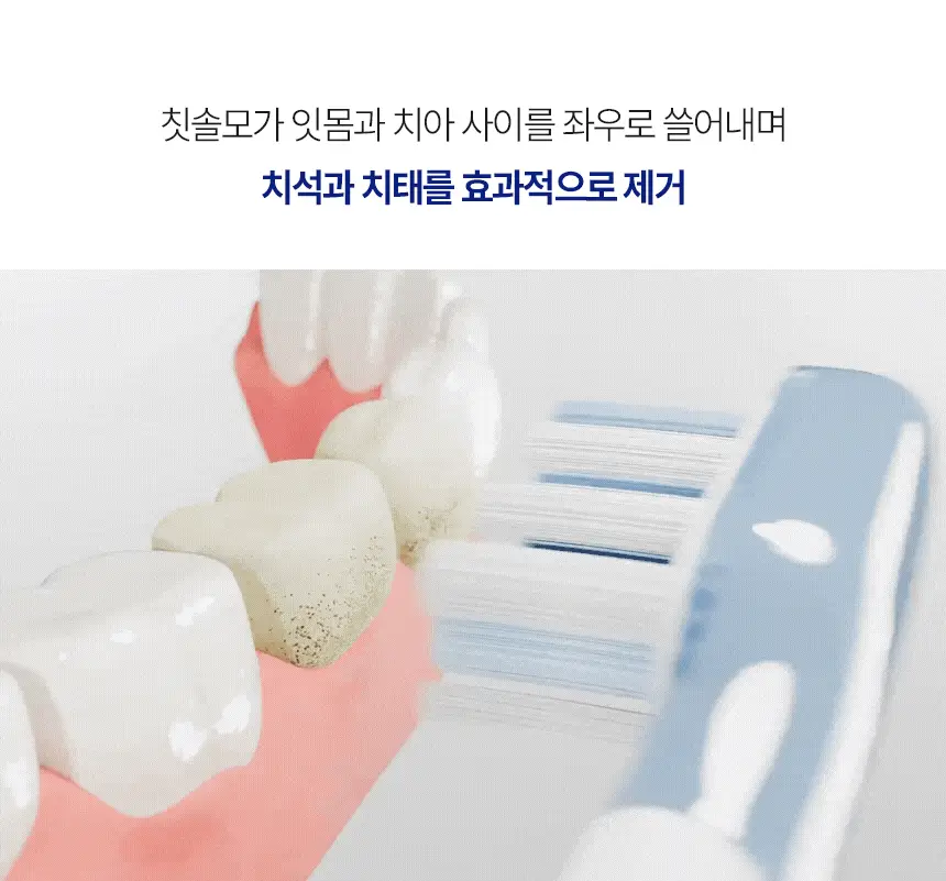 [FDA 인증] 알로코리아 듀얼덴티 좌우회전 음파 전동칫솔 ATA1S 상세페이지 11